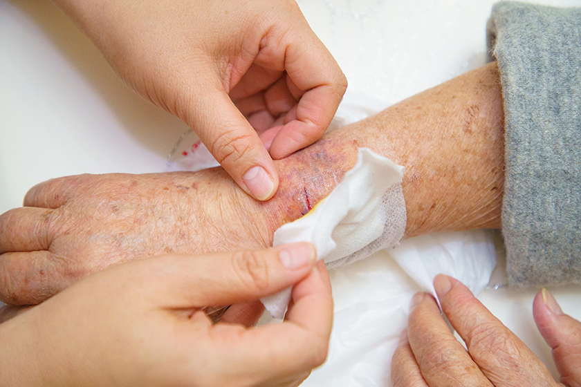 Healing Skin Tears In Elderly Individuals: Effective Treatment Strategies