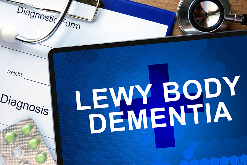 Lewy Body Dementia: A Look At Its Different Stages